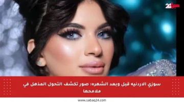 سوزي الأردنية قبل وبعد الشهرة: صور تكشف التحول المذهل في ملامحها